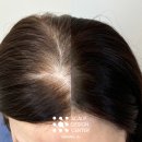 스칼프디자인센터 광주점 이미지