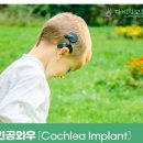 와우보청기 이미지