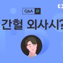 더 눈부심 이미지