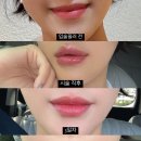 뉴스타 | 강남 입술필러 + 입꼬리보톡스 뉴스타 만족스러운 한 달 경과 후기