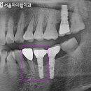 서울하이탑치과의원 이미지