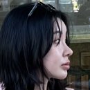 여우야뷰티카페 | 광대축소+코수술+풀페이스 지방이식 4년 차 솔직후기 (볼처짐, 사후관리 루틴, 직장인 일주일 복귀 팁)