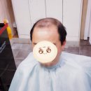 김호증모가발춘천체인점