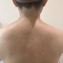 바르다, 피부 | [이도동 바르다피부] 결혼식 앞두고 등드름 관리 받고 온 후기!4회까지의 기록