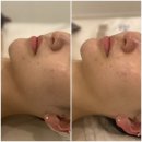 (주)제이메디 | 인천 송도 연예인관리 효과 대박인 송도윤곽관리 LPG 엔더몰로지 윤곽&amp;바디관리▶제이메디스킨케어