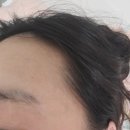구리올바디한의원 네이버블로그
