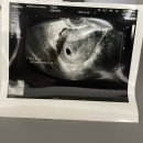 한마음산부인과 | 임신 초기 기록 5주-16주 (창원한마음병원 산부인과 진료 후기)