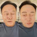 예쁨그리다 | 경남 김해시 관동동 맨즈 브로우 예쁨을그리다 후기