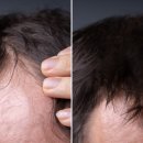 비엔엘에스테틱아카데미 이미지