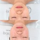 더예뻐지다 | 전주 웨딩관리 더예뻐지다 에코시티점 신부관리 나만의 맞춤케어
