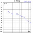 도화보청기 이미지