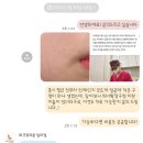 파크뷰의원 | 인천 위너확장구멍 제거 파크뷰의원 내돈내산 후기