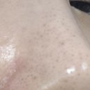 오즈코 | 오즈케어 모공케어 블랙헤드케어, 간편한 블랙헤드 관리 패치 후기