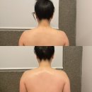 울산 달동 피부관리 &#39;스킨뮤제&#39; 플라즈마 염증 재생 관리, 재방문 후기