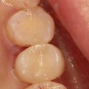 차플란트치과의원 이미지