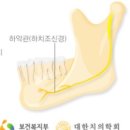 승치과의원 티스토리