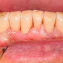 수원심미치과기공소 이미지