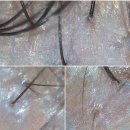 닥터안헤어플란트의원 이미지