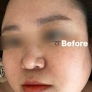 다대포 에스테틱 [피예날 에스테틱] 피부가 예뻐지는 날 다대포 피부샵 후기