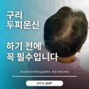 제일장의용품 | 구리 두피문신, 하기 전에 한 번은 꼭 보셔야 합니다