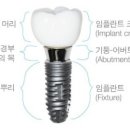 한규돈치과 네이버블로그