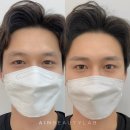 아인뷰티 이미지