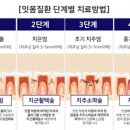 at센터 맞은편 이미지