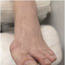 네일샵에스 아를솔즈 문제성발톱 발각질 네일 | 목동 신정동 내성발톱 파고드는발톱 벗어나게 해준 네일샵에스 아를솔즈