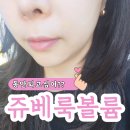 금강산약국 | 팔자주름 부산피부과 쥬베룩 볼륨후기