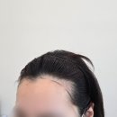 스테이 무아 | 인천 헤어라인 문신 SMP 송도 스테이무아 후기