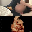 동아컴퓨터세탁공장 | 아기방꾸미기. 임산부 먹방. 만삭홈스냅. 빨래공장 시작. 출산가방 싸기. 아기용품. 광주 더블유여성...