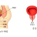 전립소 건강 챙기기 이미지