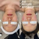 미니뷰티 이미지