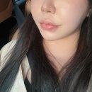 강남 입술필러 잘하는 곳 채움필러 전후사진 / 강남역피부과 내돈내산 후기