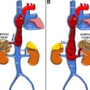 부신메디칼 이미지