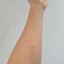 밝은미소한의원 | 대전두드러기치료 하늘체한의원 가볼까 고민될 때, 피부과 약 끊고 잘하는곳 찾아야 하는 이유가 뭘까요?