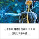 신경통[neuralgia] 이미지