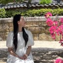 서면굴다리돌출형 부 | 부산 매부리 긴코 화살코 코성형 솔직후기(붓기 멍 과정)