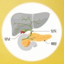 HCC = Hepatocellular carcinoma = 간암의 진단과 치료 이미지