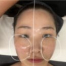 남구-117 | [대구/남구] 라플러스에스떼/대구웨딩관리/민감예민피부/리얼후기