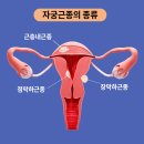 엔스온누리약국 네이버블로그