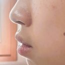 아인스치과의원 | [2차 교정일기] 강남교정전문치과에서 입툭튀증상으로 2차 교정 중인 준이의 치아교정 전후 후기