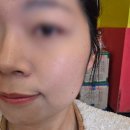 아담에스테틱 - 통영시 | 건조한 피부 다시나기 - 충주 여드름 관리는 아담에스테틱 방문 후기