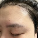 더굿코스메틱 민감성여드름세럼 아크제로세럼 사용후기