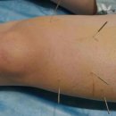 세중한의원 국제도시점 이미지