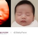 더블유여성병원 네이버블로그