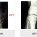 유우석한의원 네이버블로그