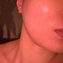 개봉제일시장 - 2462 | [개봉피부관리] 유수분밸런스 무너진 여름철 트러블피부관리 잘하는곳 "스파블룸" 관리후기