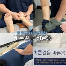 춘천번개시장 | [춘천재활/춘천마사지] 근막통증 싹 풀리고 걸음까지 교정되는 춘천 바른걸음바른몸