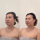 리미에스테틱&왁싱 | [웨딩일기] W.22 청주 작은 얼굴관리 찾다가 발견 - 리미에스테틱 윤곽관리 후기